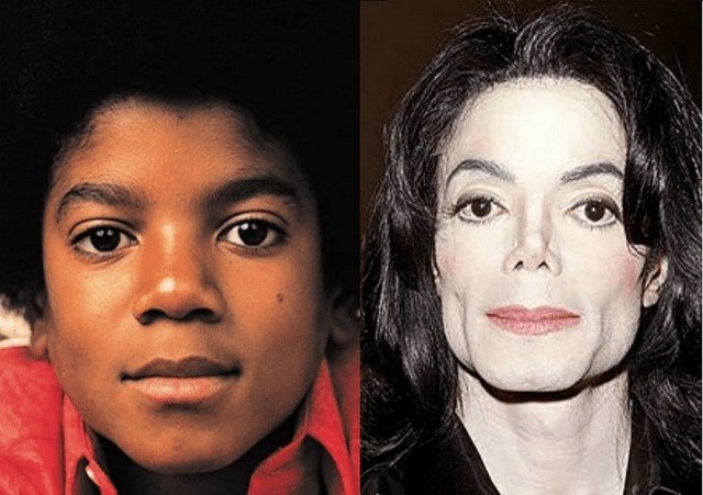 How Michael Jackson struggled with vitiligo and turned white – Ismail Akwei